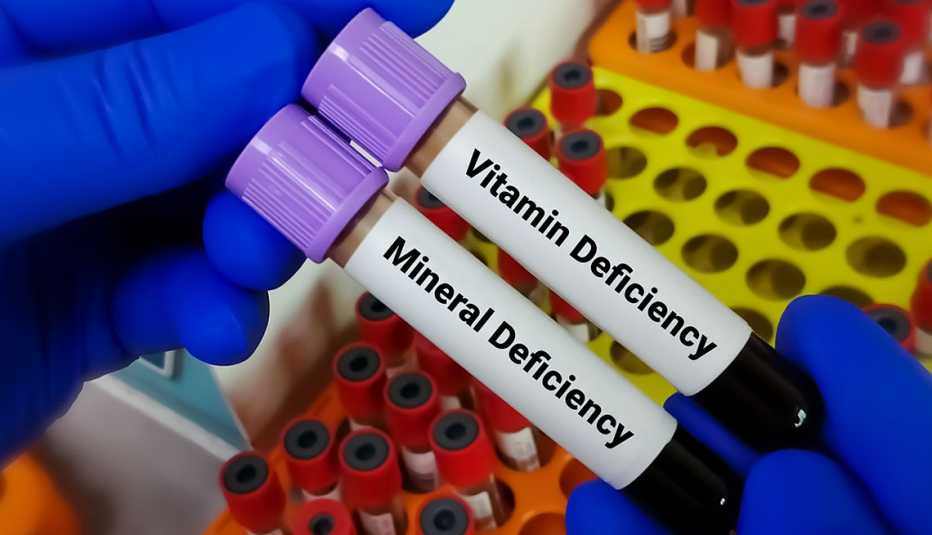 Análisis de sangre para detectar deficiencias vitamínicas
